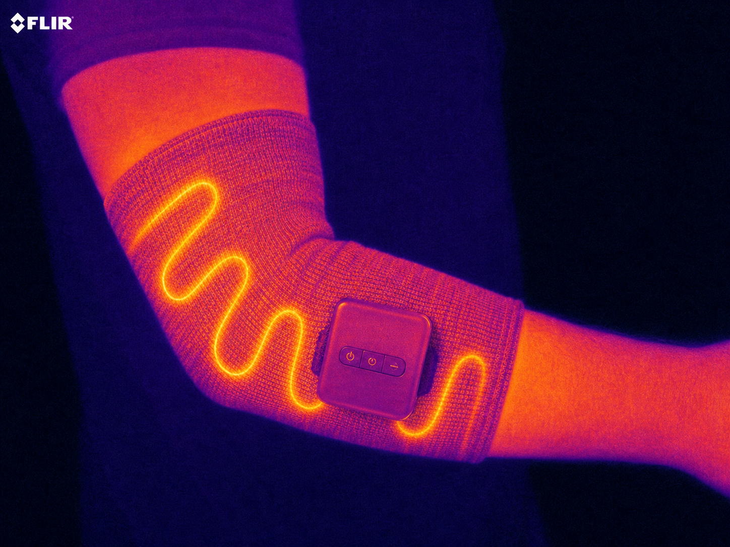 FLIR thermal camera image showing the zig-zag heat distribution pattern across the elbow joint